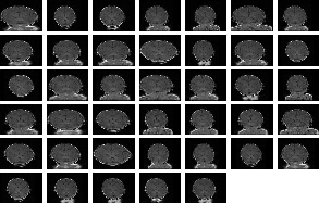 40 perturbed
versions of a baby brain images