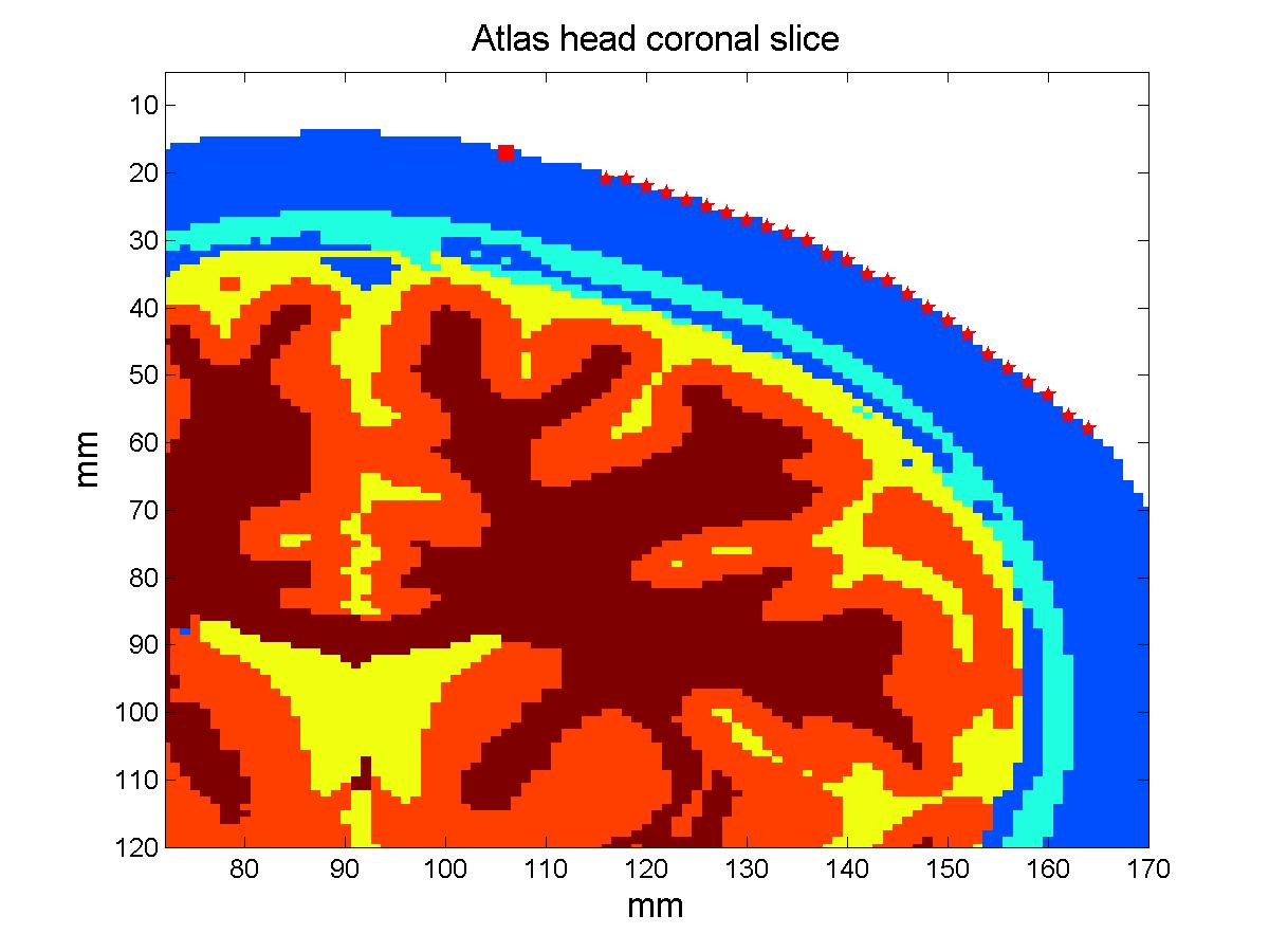 MNI Atlas coronal slice with linear probe