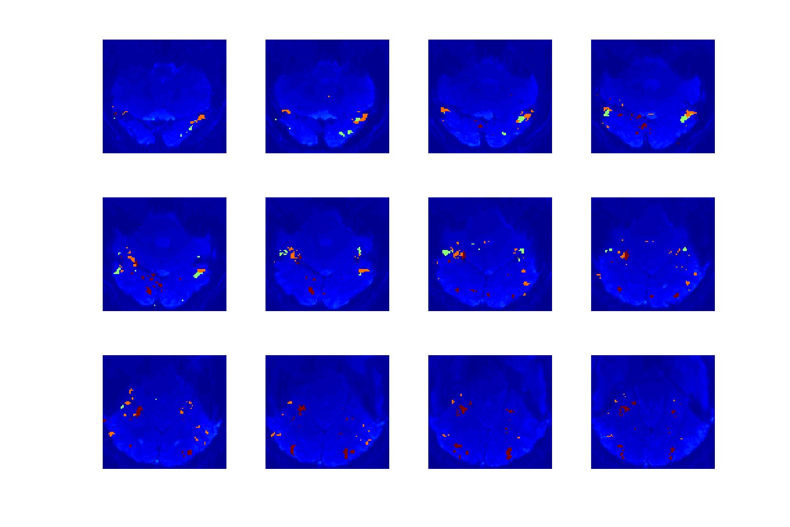 Three brain regions with high activation for faces (green,) objects (orange,) and scenecs (dark red) detected with the common statistical testing methods.